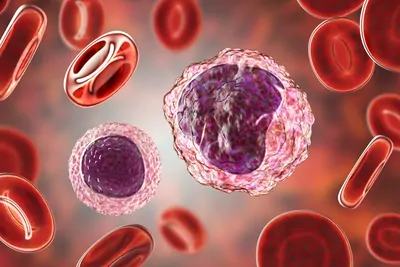 3D medical illustration of peripheral blood cells: a lymphocyte (left) and a monocyte (right) surrounded by red blood cells.